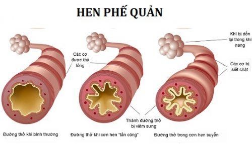 Website chính thức của Công ty CP Dược Thảo Thiên Phúc