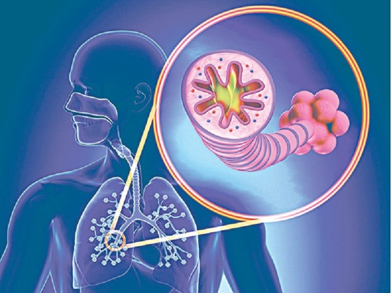 Cải thiện COPD bằng thảo dược: Nên hay không?