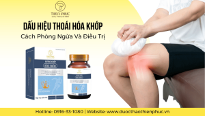 Dấu Hiệu Thoái Hóa Khớp: Cách Phòng Ngừa Và Điều Trị