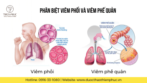 Phân Biệt Viêm Phổi và Viêm Phế Quản: 3 Yếu Tố Chính Cần Biết