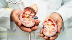 Điều Trị Bệnh Thận Tại Nhà