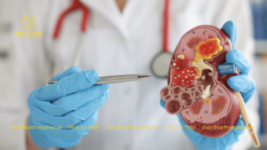 Thận Yếu Có Nguy Hiểm Không?