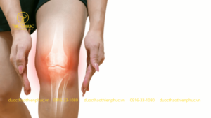 Thoái Hóa Xương Khớp Gối Là Gì? - Làm Thế Nào Để Bớt Cơn Đau