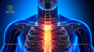 Triệu Chứng Thoát Vị Đĩa Đệm