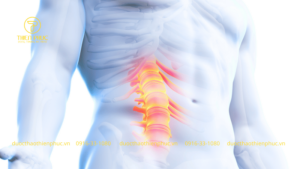 Gai Cột Sống Có Nguy Hiểm Không?