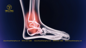 Uống Sữa Giúp Xương Chắc Khỏe Không?