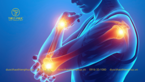 Thói Quen Giúp Xương Chắc Khỏe